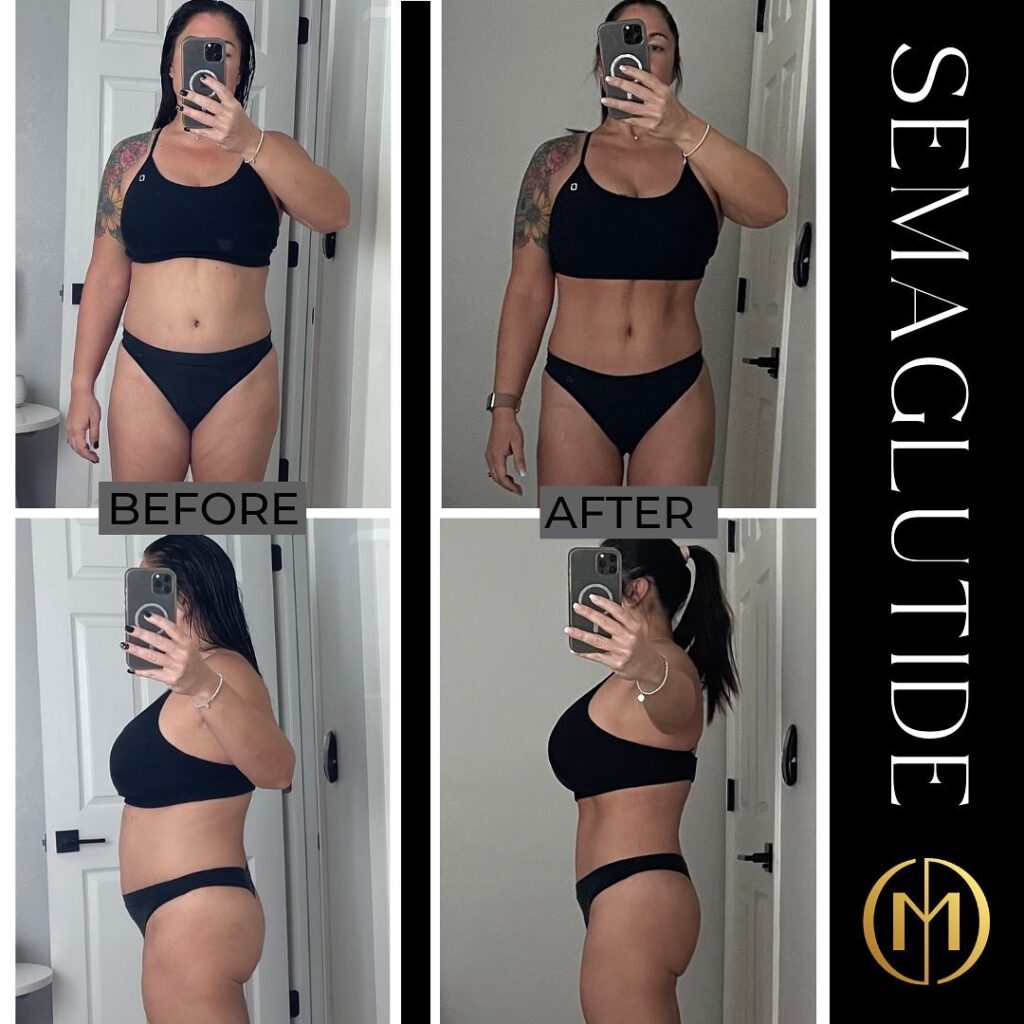 Before and after of a client at CurateMD Skin Bar and Wellness Clinic with Semaglutide