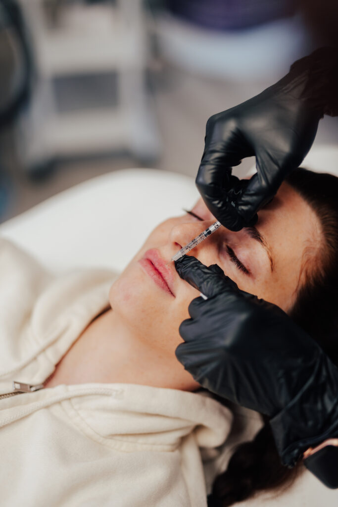 injection of the lips